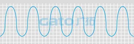 干貨|太全了，振動(dòng)光纖7大場(chǎng)景的安裝方式圖文詳解！(圖21)